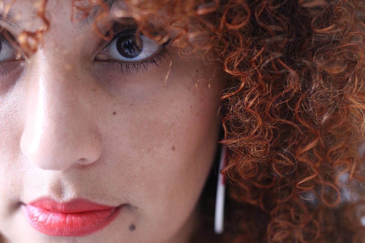 Pigmentvlekken: oorzaken, soorten & behandeling